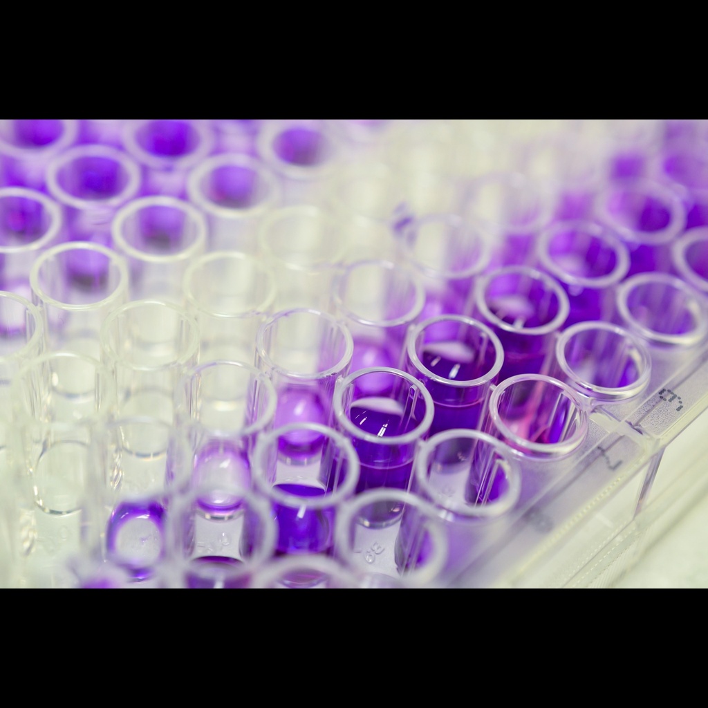 Rat INS Insulin  ELISA Kit size: 96 Tests