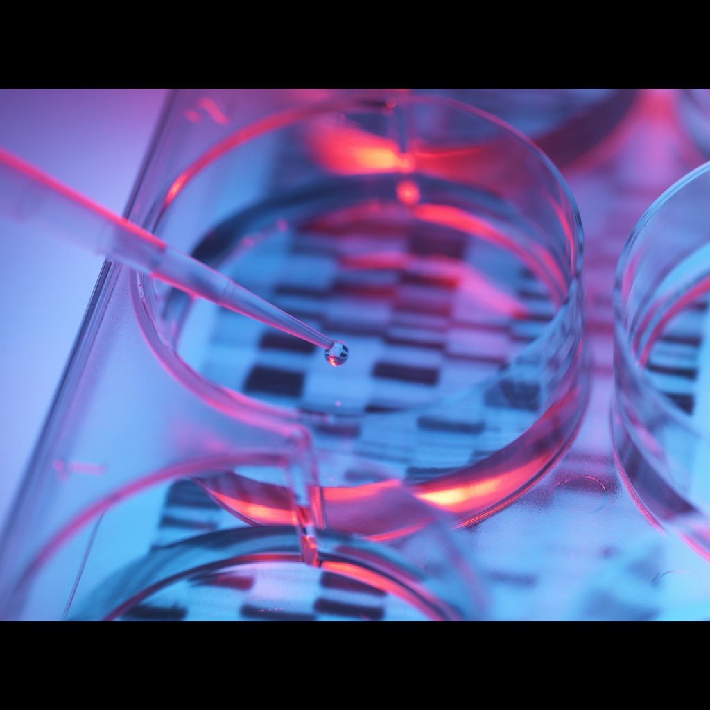 Universal cDNA Reverse Transcribed by Random Hexamer: Mouse Normal Tissues size: 100 Reactions