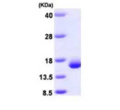 [MC07-100] Recombinant Human Galectin 2, His Tag -100 ug