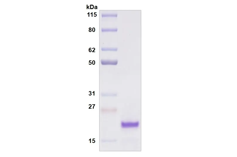 [MC11-025] Recombinant Human Siglec-8, His Tag -25 ug